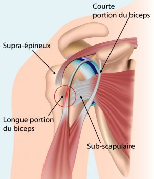 Tendon du long biceps