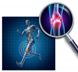 Arthrose du genou
