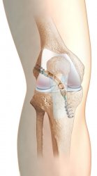 Intervention ligaments croisés anterieurs genou Colmar