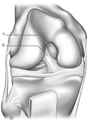 Ligament croisé antérieur genou colmar