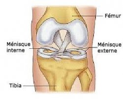 Lesions meniscales